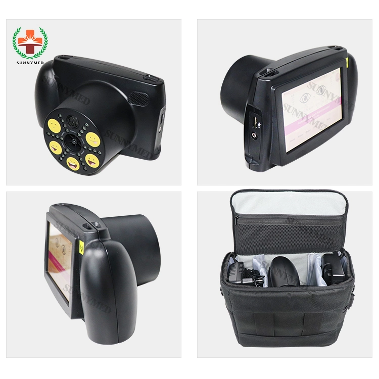 Portable Ophthalmic Machine Vision Screener Auto Refractometer